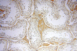 Symplekin Antibody in Immunohistochemistry (Paraffin) (IHC (P))