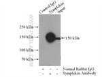 Symplekin Antibody in Immunoprecipitation (IP)