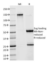 Creatine Kinase-BB (CK-BB) Antibody in SDS-PAGE (SDS-PAGE)