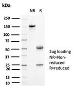 Creatine Phosphokinase-BB (CK-BB) Antibody in SDS-PAGE (SDS-PAGE)