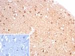 Creatine Phosphokinase-BB (CK-BB) Recombinant Mouse Monoclonal Antibody (rCKBB/8844)