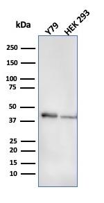 Creatine Phosphokinase-BB (CK-BB) Antibody in Western Blot (WB)