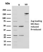 Creatine Phosphokinase-BB (CK-BB) Antibody in SDS-PAGE (SDS-PAGE)
