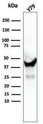 Creatine Phosphokinase-BB (CK-BB) Antibody in Western Blot (WB)
