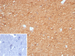 Creatine Phosphokinase-BB (CK-BB) Recombinant Rabbit Monoclonal Antibody (CKBB/8295R)