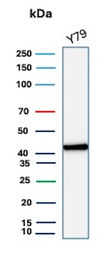 Creatine Phosphokinase-BB (CK-BB) Antibody in Western Blot (WB)