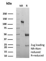 Creatine Phosphokinase-BB (CK-BB) Antibody in SDS-PAGE (SDS-PAGE)