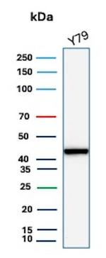 Creatine Phosphokinase-BB (CK-BB) Antibody in Western Blot (WB)