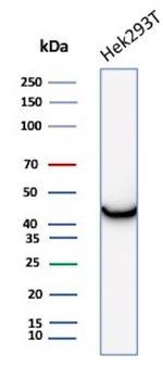 Creatine Phosphokinase-BB (CK-BB) Antibody in Western Blot (WB)