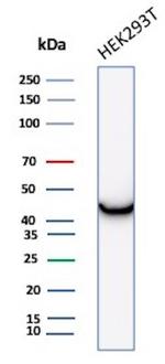 Creatine Phosphokinase-BB (CK-BB) Antibody in Western Blot (WB)