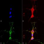 TrpC7 Ca+2 Channel Antibody in Immunocytochemistry (ICC/IF)