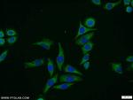 MCC Antibody in Immunocytochemistry (ICC/IF)