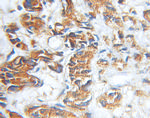 MCC Antibody in Immunohistochemistry (Paraffin) (IHC (P))