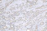 MCC Antibody in Immunohistochemistry (Paraffin) (IHC (P))