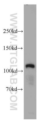 MCC Antibody in Western Blot (WB)
