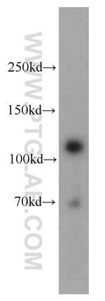 MCC Antibody in Western Blot (WB)