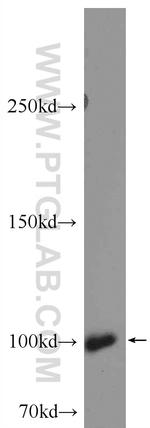 MCC Antibody in Western Blot (WB)