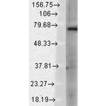 TrpV3 Cation Channel Antibody in Western Blot (WB)