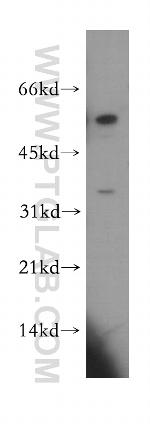 CCDC28B Antibody in Western Blot (WB)