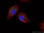 FBF1 Antibody in Immunocytochemistry (ICC/IF)