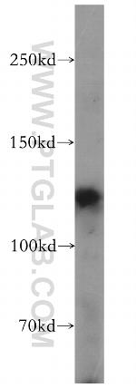FBF1 Antibody in Western Blot (WB)