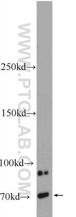 FBF1 Antibody in Western Blot (WB)