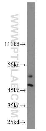 CaMKII beta Antibody in Western Blot (WB)