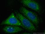 Osteoprotegerin/TNFRSF11B Antibody in Immunocytochemistry (ICC/IF)