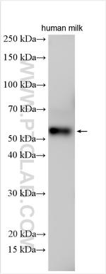 Osteoprotegerin/TNFRSF11B Antibody in Western Blot (WB)