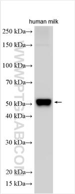 Osteoprotegerin/TNFRSF11B Antibody in Western Blot (WB)