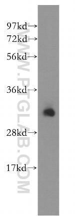 DCI Antibody in Western Blot (WB)