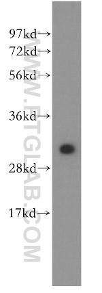 DCI Antibody in Western Blot (WB)