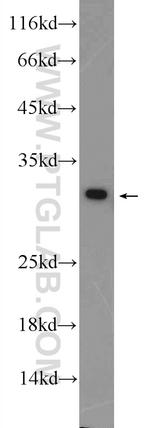 DCI Antibody in Western Blot (WB)
