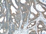PREP Antibody in Immunohistochemistry (Paraffin) (IHC (P))