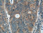 PREP Antibody in Immunohistochemistry (Paraffin) (IHC (P))