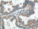PREP Antibody in Immunohistochemistry (Paraffin) (IHC (P))