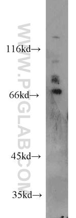 PREP Antibody in Western Blot (WB)