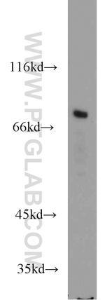 PREP Antibody in Western Blot (WB)