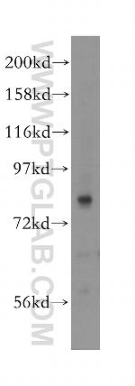 PREP Antibody in Western Blot (WB)