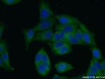 LRRC8D Antibody in Immunocytochemistry (ICC/IF)