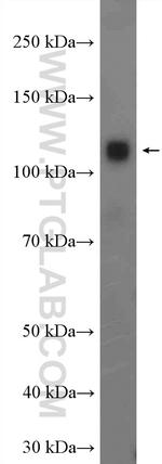 LRRC8D Antibody in Western Blot (WB)