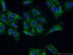 TUSC2 Antibody in Immunocytochemistry (ICC/IF)