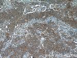 TUSC2 Antibody in Immunohistochemistry (Paraffin) (IHC (P))