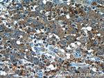 TUSC2 Antibody in Immunohistochemistry (Paraffin) (IHC (P))