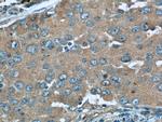 TUSC2 Antibody in Immunohistochemistry (Paraffin) (IHC (P))