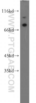 MAGED1 Antibody in Western Blot (WB)