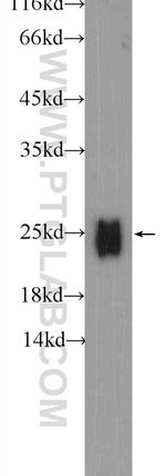 IgG light chain (lambda) Antibody in Western Blot (WB)