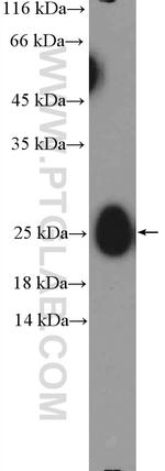 IgG light chain (lambda) Antibody in Western Blot (WB)