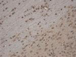 TrpC5 Ca+2 Channel Antibody in Immunohistochemistry (IHC)
