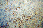 DBC1 Antibody in Immunohistochemistry (Paraffin) (IHC (P))